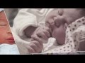 Doğum Hikayesi SlideShow