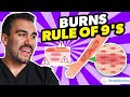 Burns Nursing Overview | Rule of Nines, Types, Causes, Care