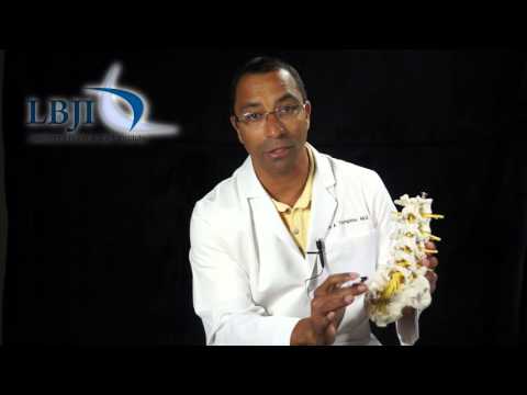 Dr. Anton Thompkins Explains Lumbar Laminectomy