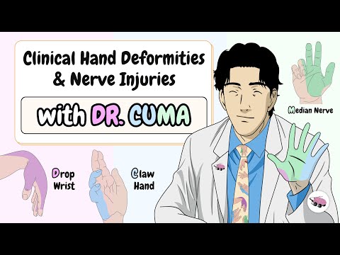 Hand Deformities: Drop Wrist, Claw Hand, Ape Hand & Sign of Benediction with “DR. CUMA”