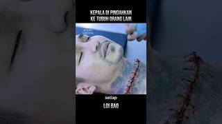 Download lagu This Man Dared to Transplant His Head onto Another Body! 😱🧠 #movierecap #shorts mp3