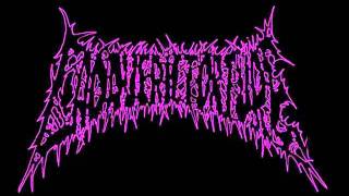 Cadaveric Torture - Amputated Dismemberment.wmv