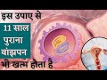 इस उपाए से 𝟭𝟭 साल पुराना बांझपन भी खत्
