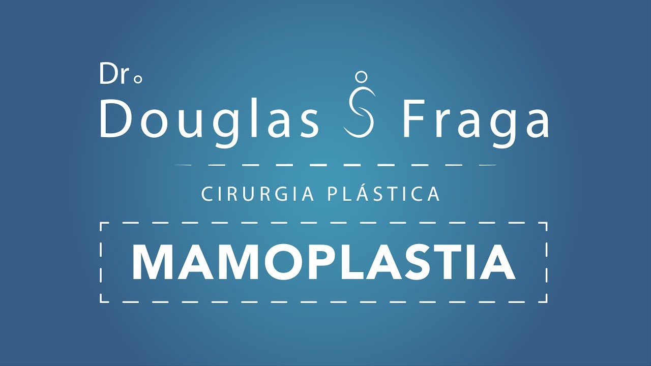 Douglas Severo Fraga-13