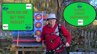 Olympic Recurve Sight Picture: A Quick Look