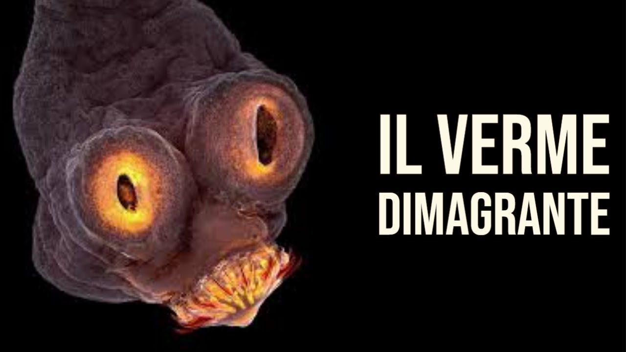 Il verme che fa DIMAGRIRE - La Tenia