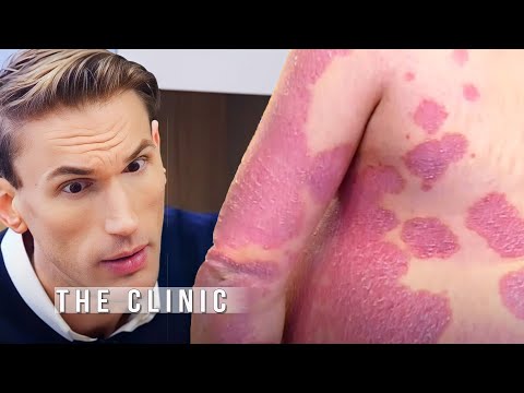 Doctors Shock at Rare Skin Disease! 😲