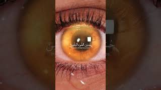 والله بالله  | حسين الضوة البالعين