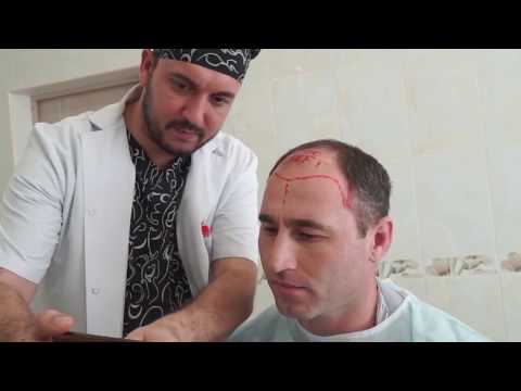 Nur Hair Center - Hair Transplant