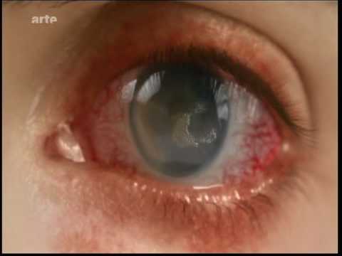 UMWE04-V26-Versenktes Gift-2-1min-Zitat arte-25.2.2014