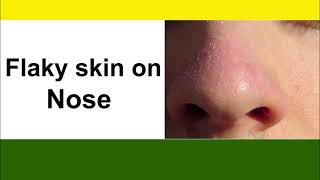 Home Remedies For Flaky Skin On Nose