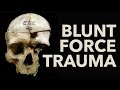 VIOLENCE CONFLICT In The STONE AGE A Prehistory Guys Special