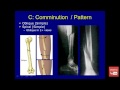 Types of bone fractures pdf