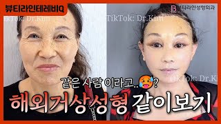 이렇게 성형.. 괜찮을까? SNS에서 유명한 해외성형수술 같이보기!