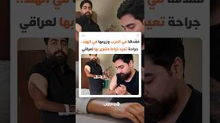فقدها في الحرب وزرعها في الهند.. جراحة تعيد ذراعا متبرع بها لعراقي thumbnail