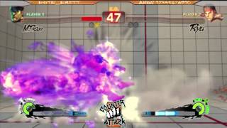 preview picture of video 'SSF4AE: BOTB_Brett [M.Bison] vs Anon12345678910 [Ryu] Counter Attack 2014'