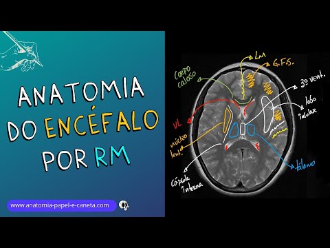 Anatomia do ENCÉFALO por RM - DICAS de como localizar as estruturas no exame