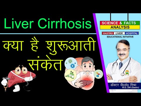 Liver Cirrhosis क्या है शुरुआती संकेत ? || CIRRHOSIS OF LIVER