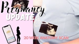 20 Weeks | Anatomy Scan | Pregnancy Update