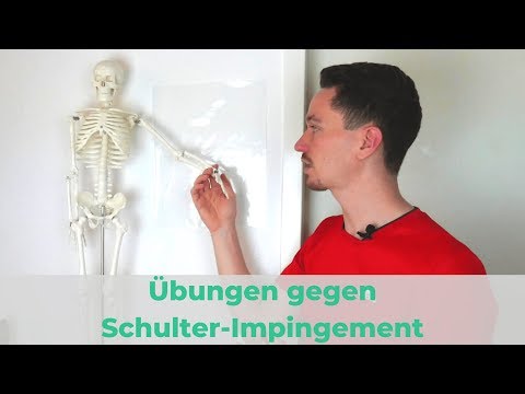 Das hilft gegen das Schulter Impingement Syndrom - Ursachen, Übungen, Therapie