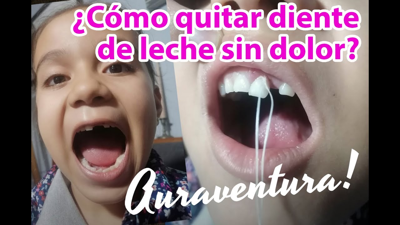 Watch Como quitar diente de leche sin dolor Now Como quitar diente de leche sin dolor