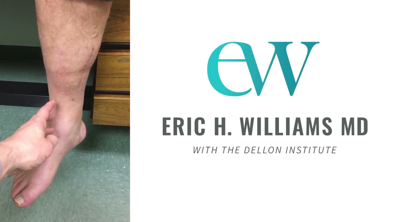 Treating Pain in Medial Ankle