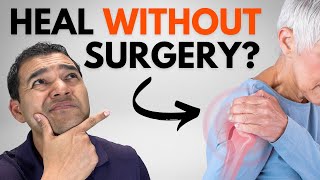 Can a Shoulder Labrum Tear ACTUALLY Heal Naturally Without Surgery