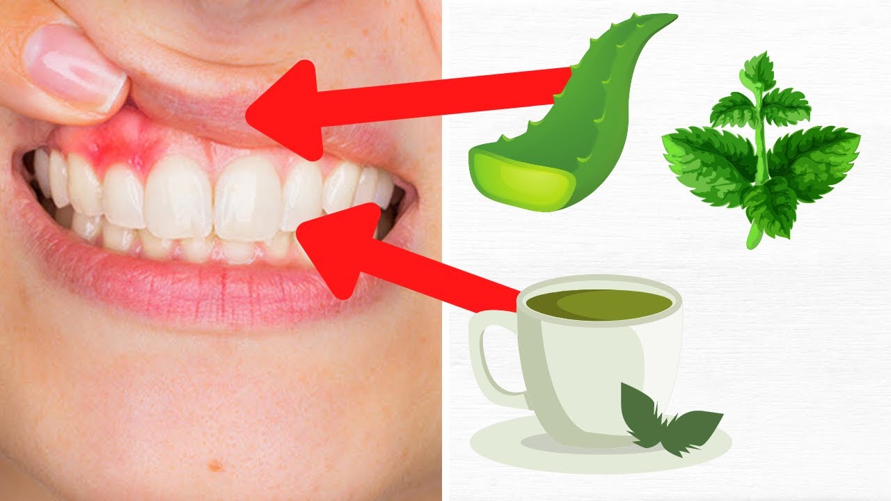 Cofanie się dziąseł - Jak naturalnie zaradzić temu problemowi zanim będzie za późno Sprawdź!