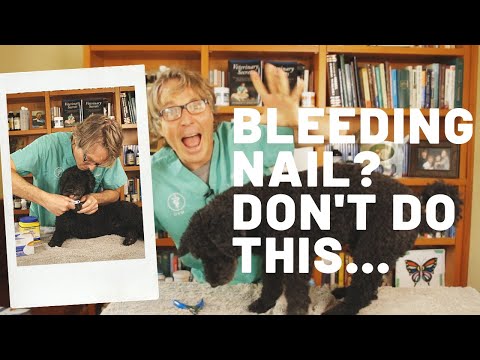 How To Quickly Stop a Bleeding Nail
