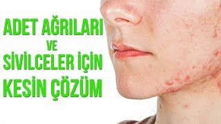 Adet Ağrıları ve Sivilceler için Çözüm Önerileri | Doktor Fitt