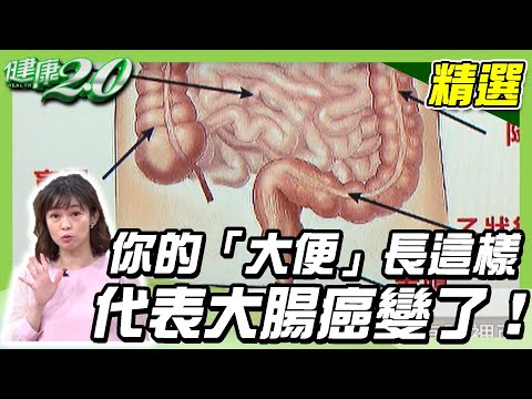 成形便