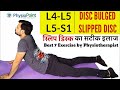 L4 L5 Disc Bulge Exercise In Hindi L4 L5 S1 Disc Bulge Herniated Disc Treatment In Hindi