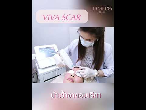 หลุมสิวรักษาหาย ต้องเลือกให้ดีด้วย Viva Scar Program #รักษาหลุมสิว #เลเซอร์หลุมสิว #ลูเครเซียคลินิก