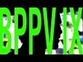 BPPV IX