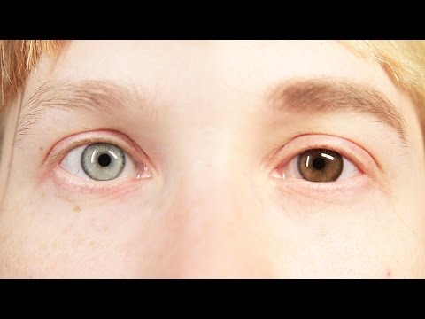 這週把眼睛換成別的顏色！(People Change Their Eye Color For A Week)