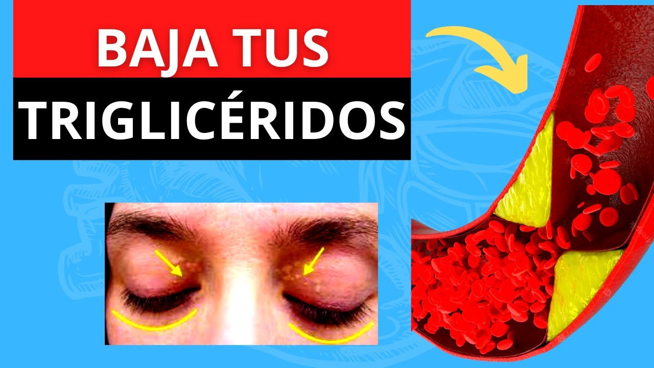 ¿CÓMO BAJAR LOS TRIGLICÉRIDOS?: alimentos, ejercicio y medicamentos