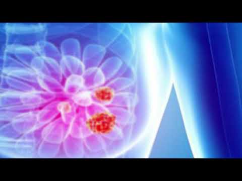 5 Arsye Perse Një Femre i Dhemb Gjoksi