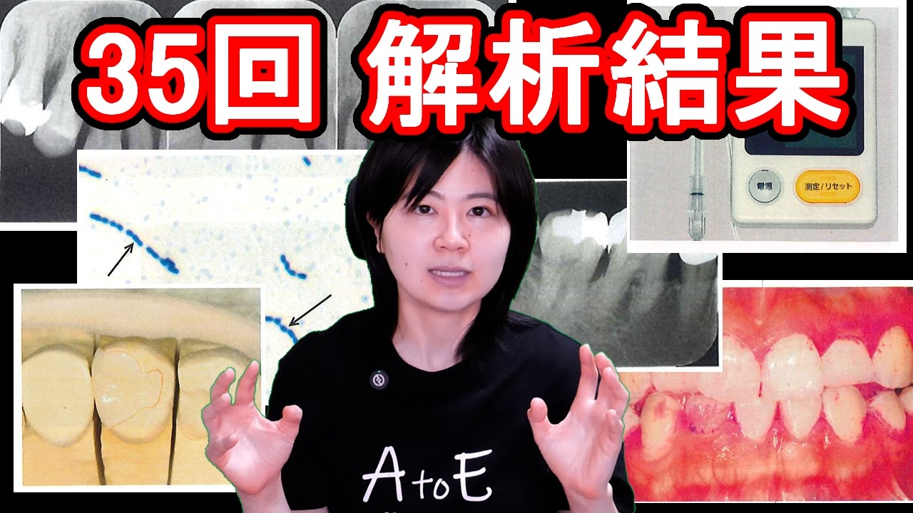 35回DH国家試験 解析しました！