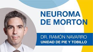 Neuroma de Morton: síntomas, diagnóstico y tratamiento