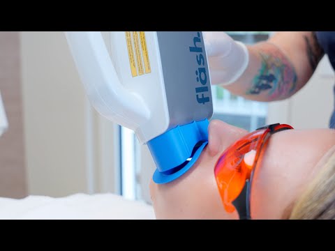 #howto fläsh In-Office Bleaching 04 von 08: Erster Zahnaufhellungsdurchgang