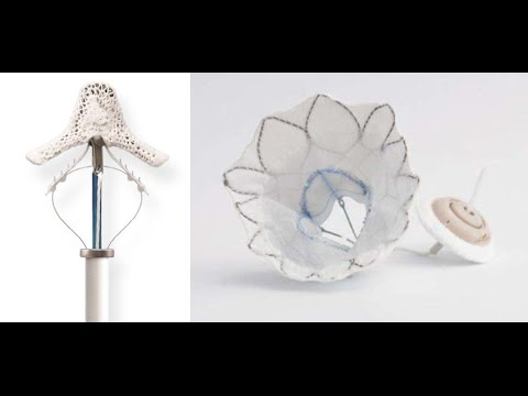 Technology Update: Transcatheter Mitral Valve Therapy with Dr. Steven Bolling