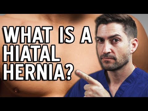 Hiatal Hernia - All 4 Types Explained!