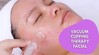 Vacuum Cupping Therapy Facial | Facial Massage | Lymphatic Drainage Massage | Part 2 myChway 2183