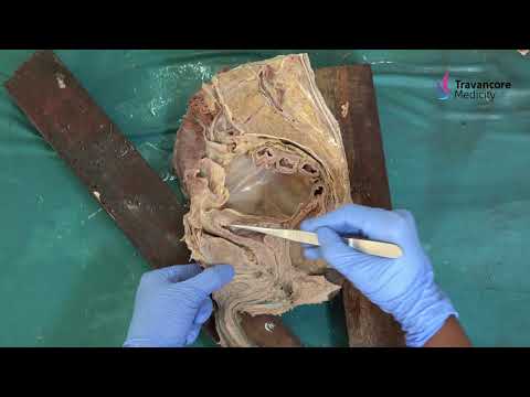 Male Pelvis  Sagittal Section