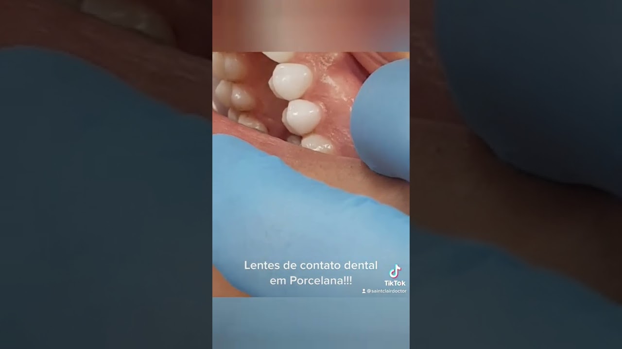 Saint Clair Barbosa Netto-32