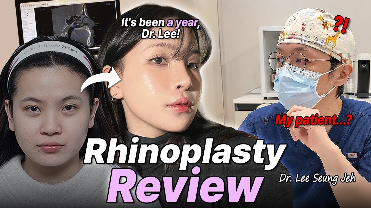 1 year later rhinoplasty results at NANA Plastic Surgery Korea YouTube video