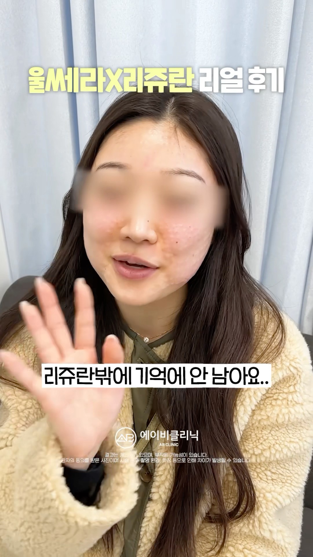 울쎄라+리쥬란 리얼 후기