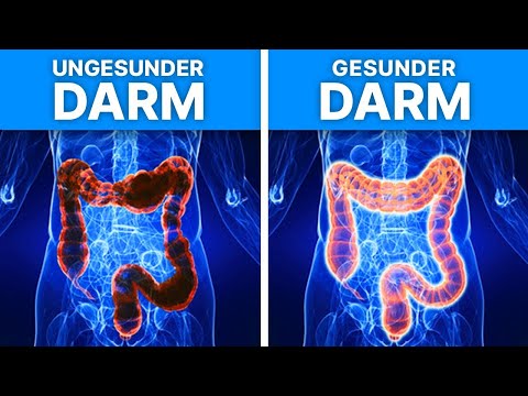 5 Lebensmittel, die du essen solltest, um deinen Darm zu reinigen!