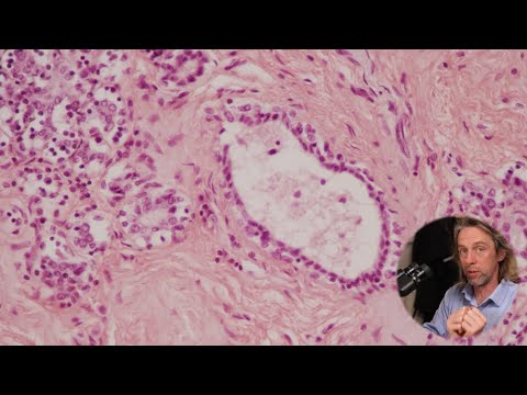 Histology of the breast