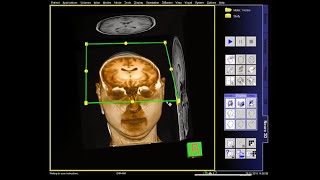 Hat der Mensch einen freien Willen? Ein Experiment sagt ...